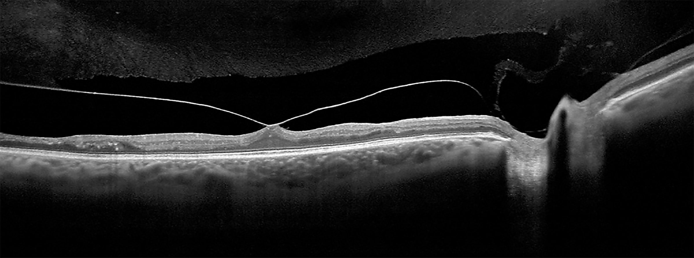 Eye Health Technology Two Rivers Eye Care